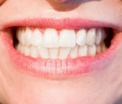 Comment prendre soin de ses dents?