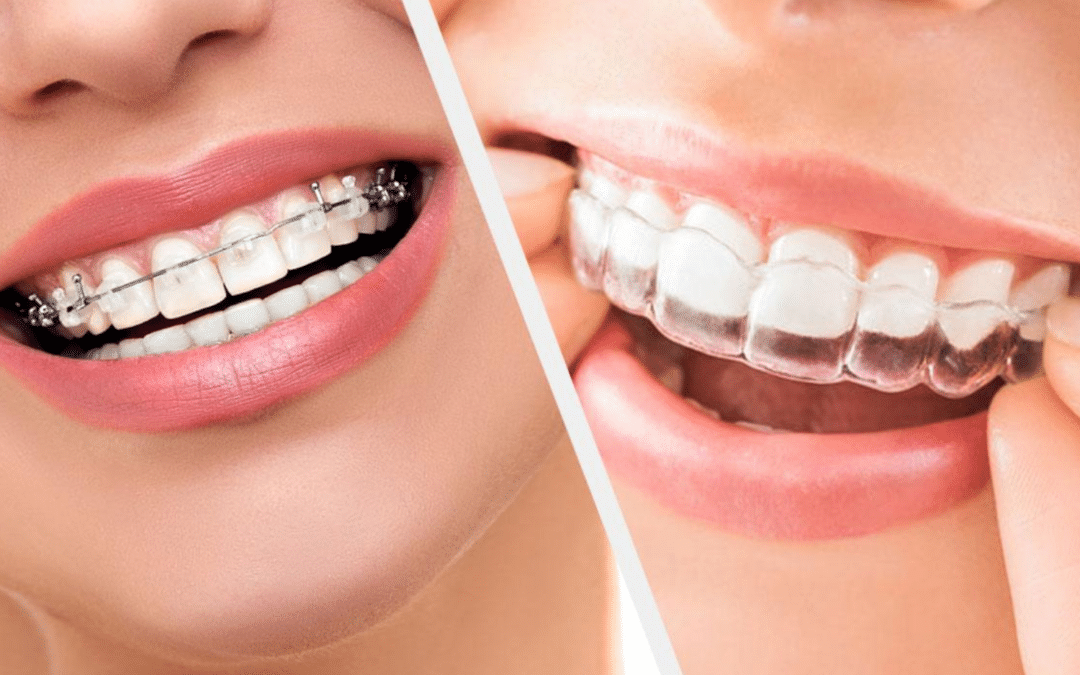 traitement orthodontique